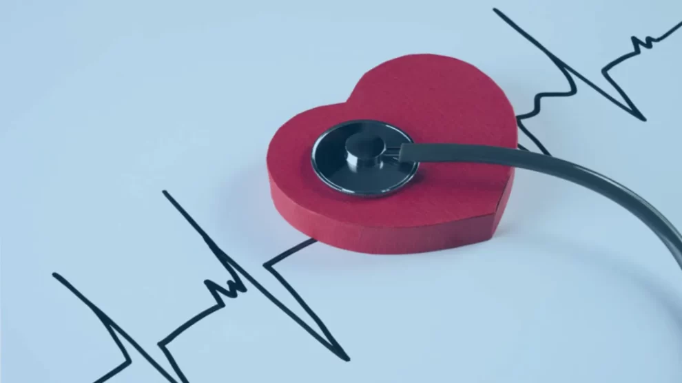 Arritmias cardíacas: Conheça as causas, os sintomas e os tratamentos