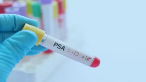 Exame de PSA: conheça o exame de sangue para identificar câncer de próstata