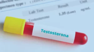 Exame de Testosterona: para que serve e como fazer