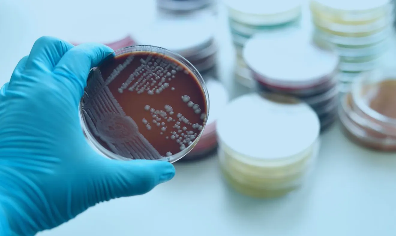 Neisseria gonorrhoeae: Como é feito e como funciona o preparo