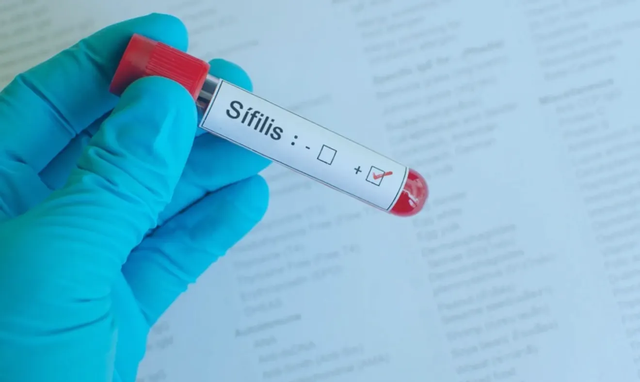 Sífilis: entenda os sintomas e saiba como se prevenir!