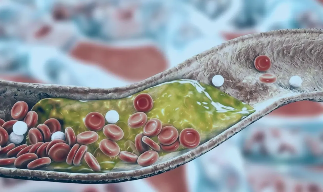 Entendendo a importância do exame de colesterol total para sua saúde