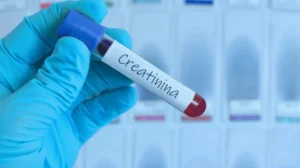 Como o exame de creatinina sérica pode detectar as doenças renais?