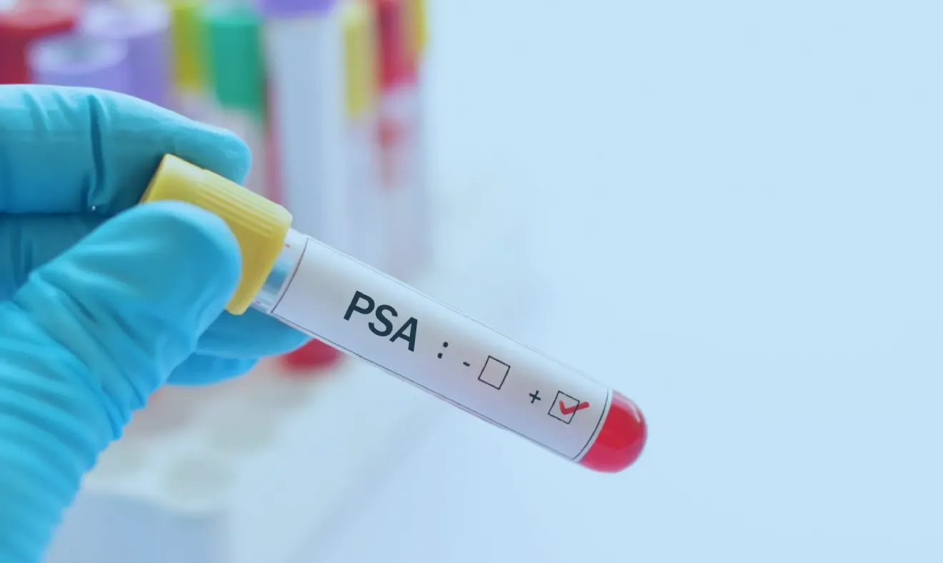 Exames PSA total e livre exames definitivos para auxiliar o