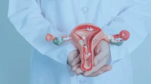Entendendo a endometriose: sintomas, diagnóstico e tratamento