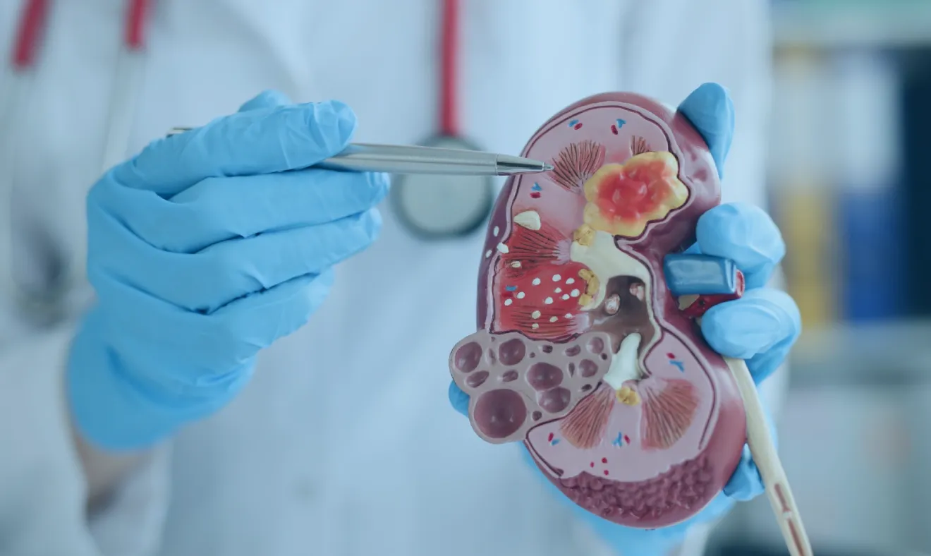 Alimentos mais prejudiciais para os rins