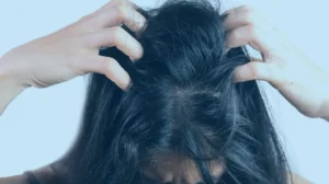Doenças dermatológicas do couro cabeludo: conheça as principais