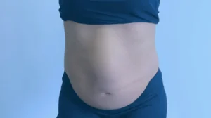 O que é distensão abdominal e quais os riscos?