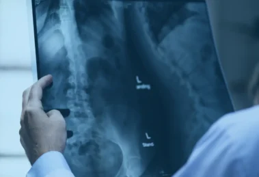 Osteoporose: o que você tem feito pela saúde de seus ossos?