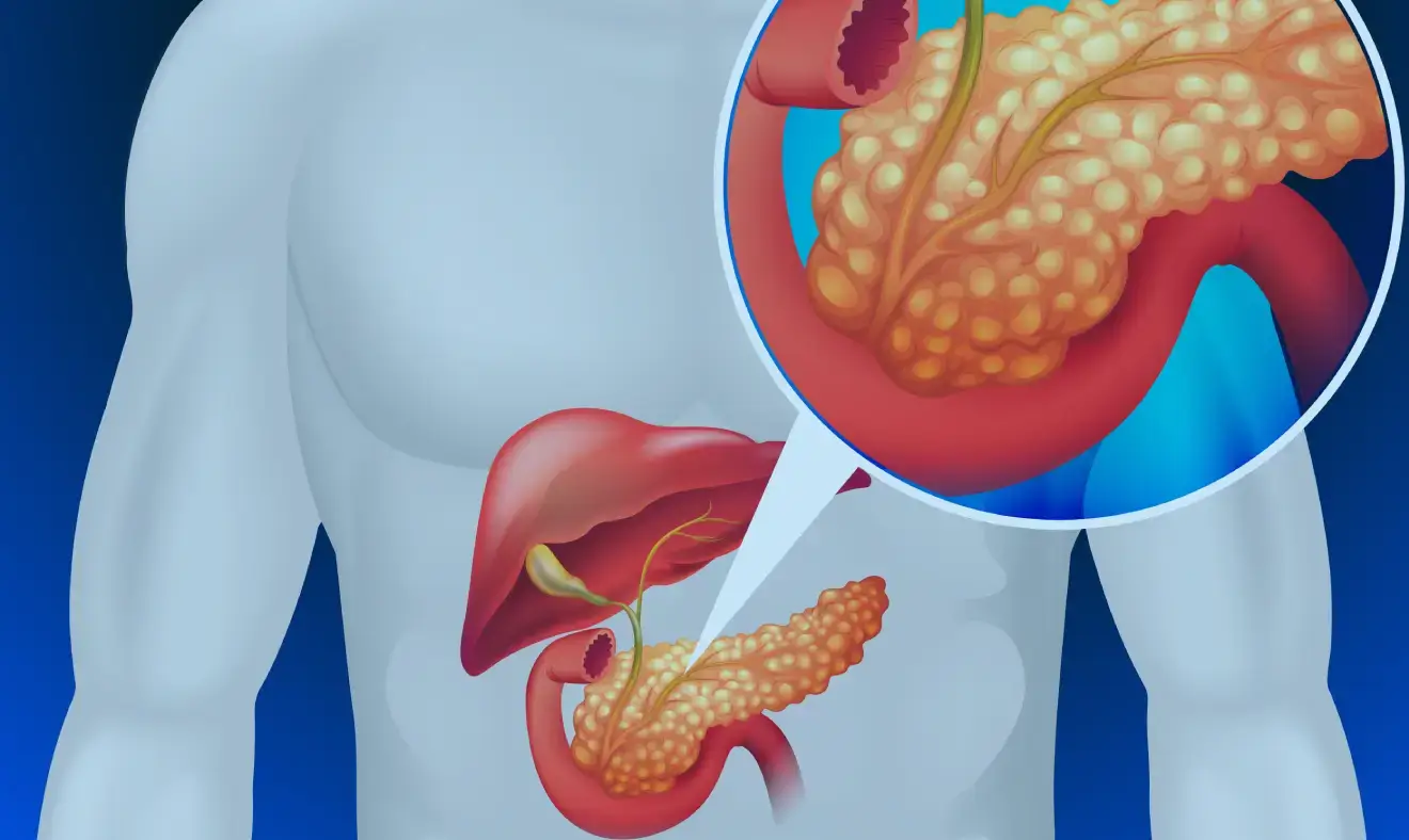 Pâncreas – Tudo o que você precisa saber sobre esse órgão.