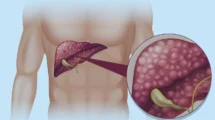 Pancreatite - O que você sabe sobre essa doença?