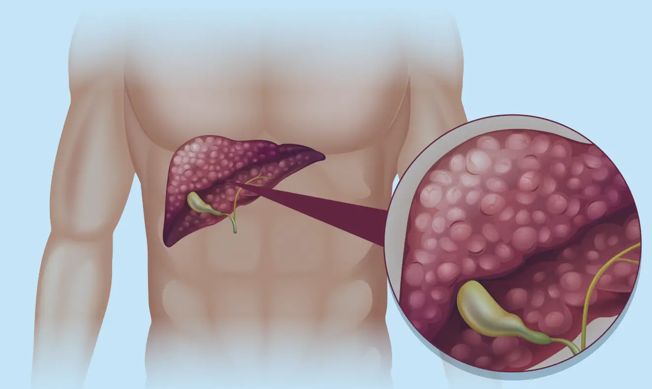 Pancreatite - O que você sabe sobre essa doença?