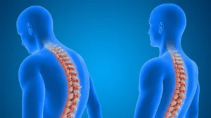 5 Problemas de coluna mais comuns