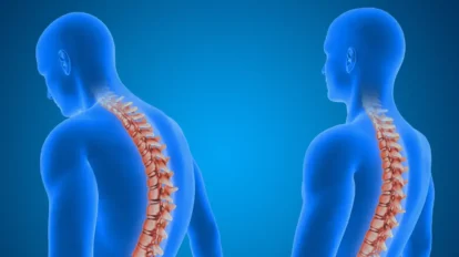 5 Problemas de coluna mais comuns