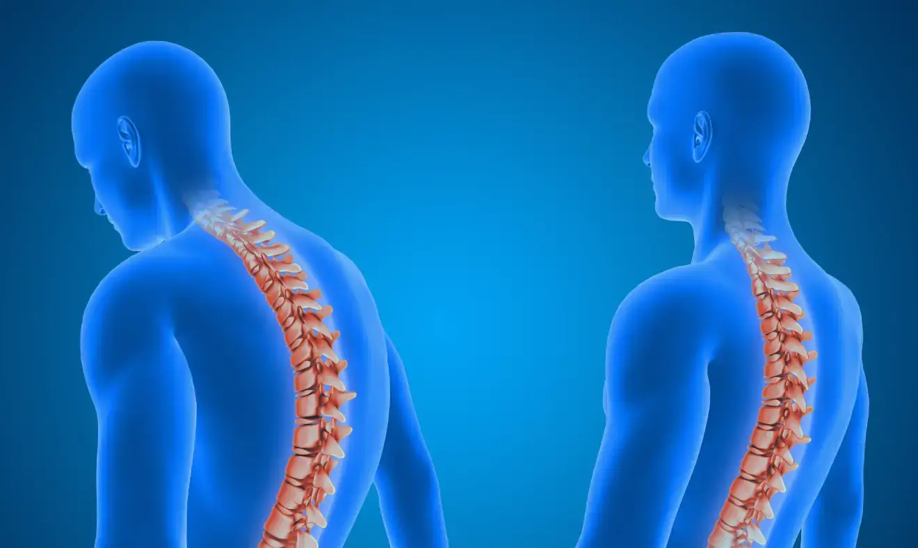 5 Problemas de coluna mais comuns