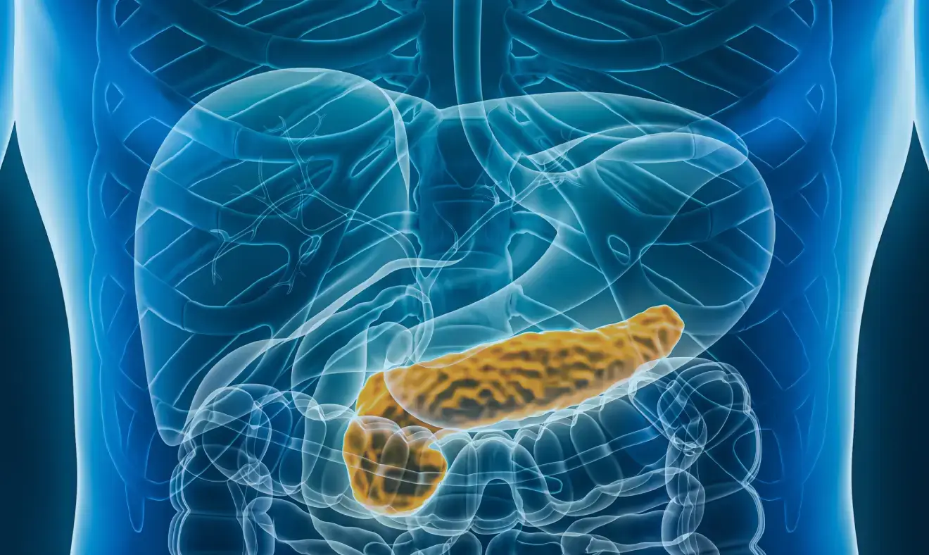 Câncer no pâncreas