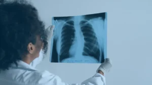 Saiba como diagnosticar doenças pulmonares com segurança
