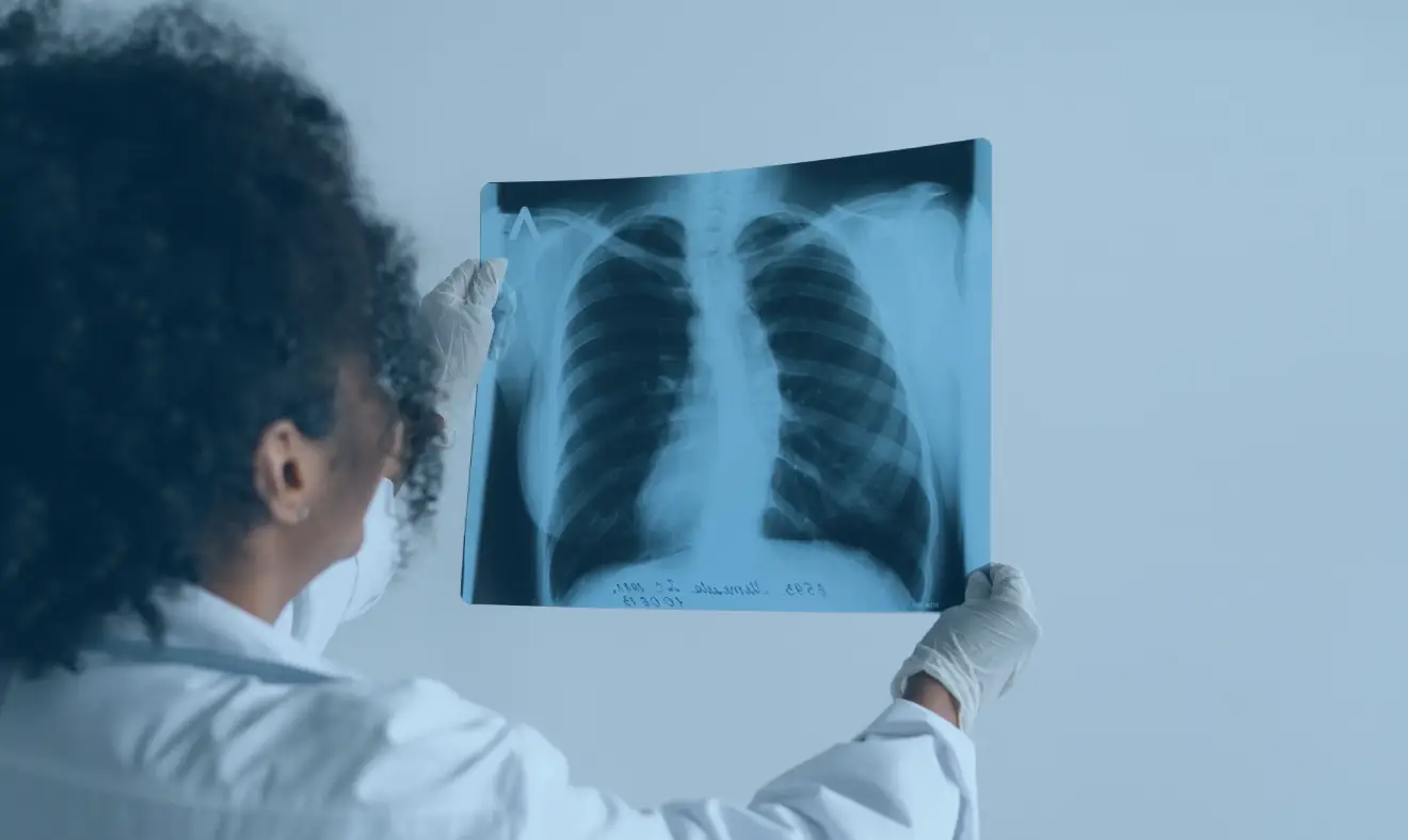 Saiba como diagnosticar doenças pulmonares com segurança