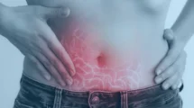 Doença de Crohn