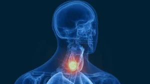 Doenças da tireoide: conheça os sintomas, causas e tratamentos