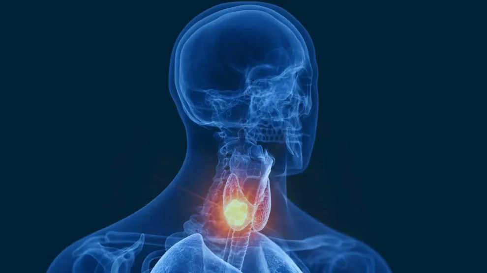 Doenças da tireoide: conheça os sintomas, causas e tratamentos