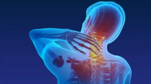 Doenças muscoesqueléticas