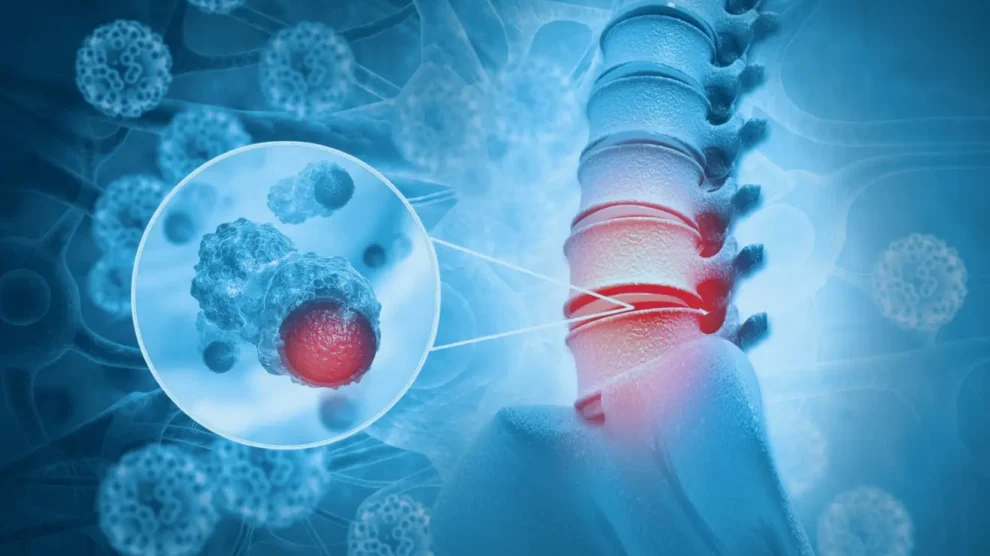 Exames preventivos para neoplasia maligna