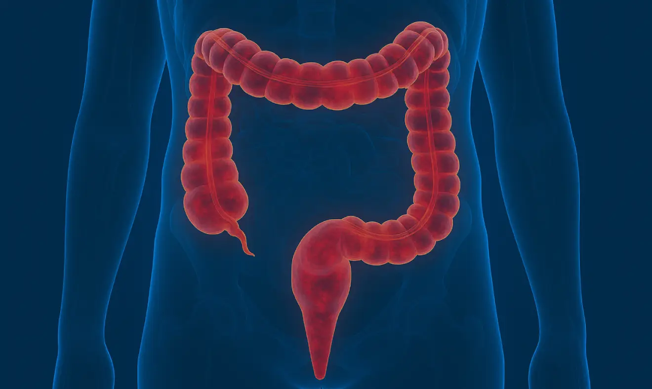 Colite ulcerosa: Principais características e exames diagnósticos